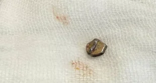 2026 4 15 18 50 45 625.webp