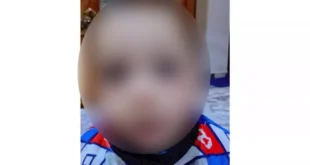 تحرك عاجل من صحة الدقهلية بعد وفاة طفل بسبب حبة فول سوداني