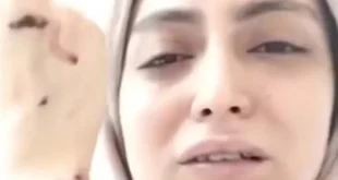 قرار نيابي جديد في قضية الاعتداء على طبيبة أسنان شبرا الخيمة