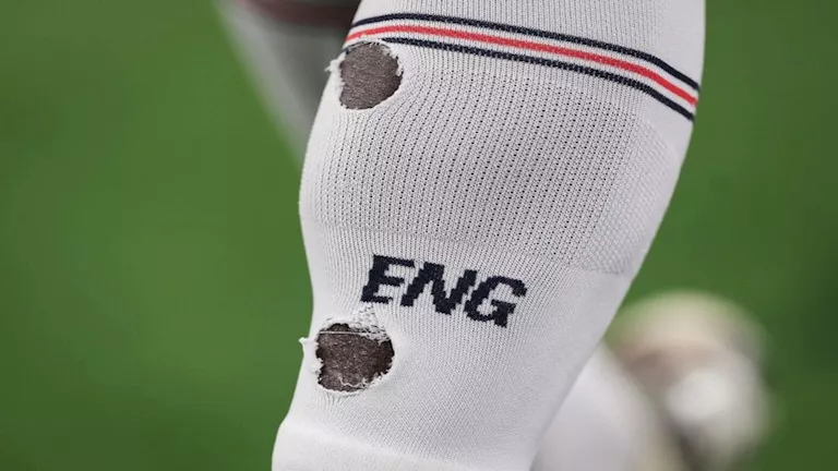 السر الطبي وراء قص أحذية وجوارب نجوم كأس العالم 2026