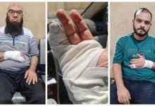 تفاصيل تحرك نقابة أطباء البحيرة بعد الاعتداء على طبيبين بحوش عيسى