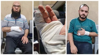 تفاصيل تحرك نقابة أطباء البحيرة بعد الاعتداء على طبيبين بحوش عيسى