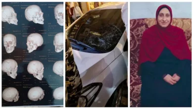 "نفسي أشوف ماما بتتكلم".. مأساة بائعة الشرابات بعد حادث دهس بدمنهور