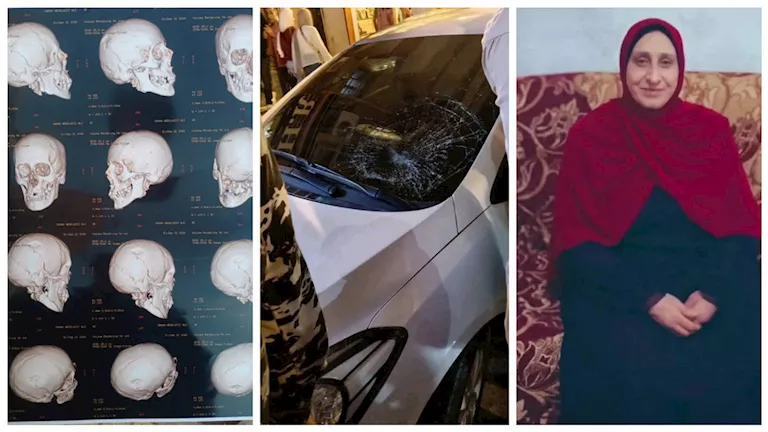 "نفسي أشوف ماما بتتكلم".. مأساة بائعة الشرابات بعد حادث دهس بدمنهور | ضي النهار "نفسي أشوف ماما بتتكلم".. مأساة بائعة الشرابات بعد حادث دهس بدمنهور