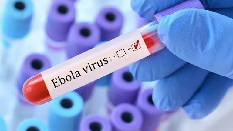ارتفاع إصابات فيروس إيبولا لـ8 حالات في كينيا